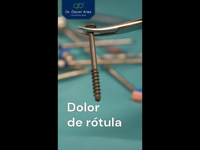 Dolor de rótula - Dr. Oscar Ares