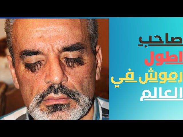 أطول رموش في العالم  رموش الاوكراني فاليري