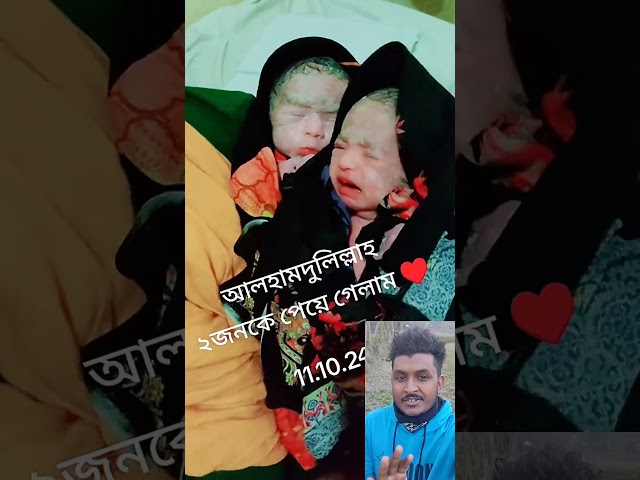 জমজ দুটি বাচ্ছার জন্য দোয়া করবেন #baby #shorts #cutebaby #cute #babyshorts #trending #viralvideo