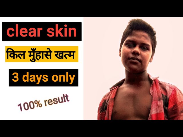 glowling skin tips at home ||whitening skin at home remedy || pradum paul