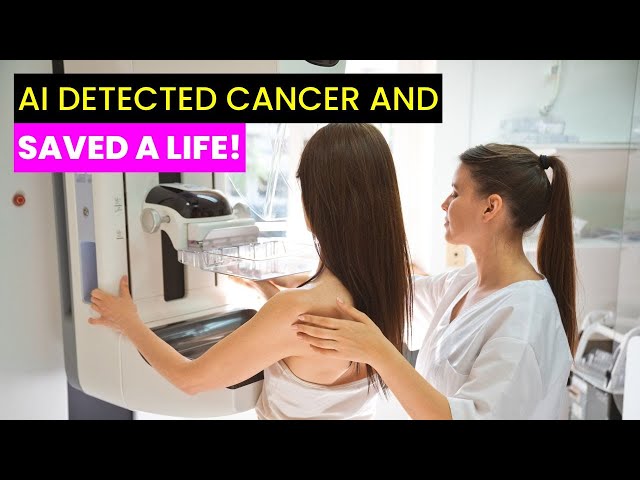 AI Detects Breast Cancer | Future Technology & Science News 519