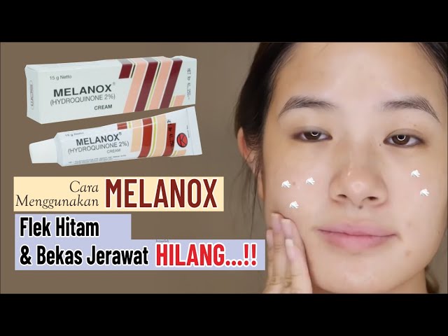 MELANOX : Cream Penghilang Flek Hitam dan Bekas Jerawat Beli di Apotek