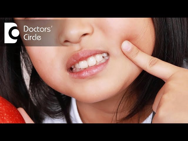 Which painkillers are safe for kids having toothache? - Dr. Arundati Krishnaraj