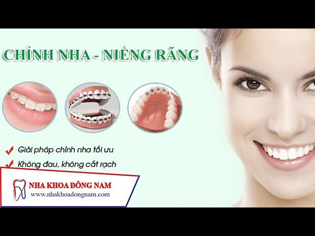 Phương Pháp Niềng Răng Là Gì? | NHA KHOA ĐÔNG NAM®