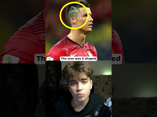 Why Did Ronaldo Have a Z Shaped Haircut in 2014?