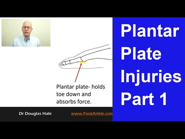 Plantar Plate Injuries - Part 1 | Seattle Podiatrist