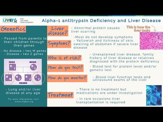 A1A Deficiency and Liver Disease, Juan Gonzalez, MD