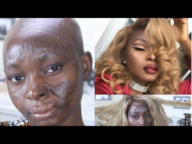 Extreme Makeover Transformation | Shalom Blac