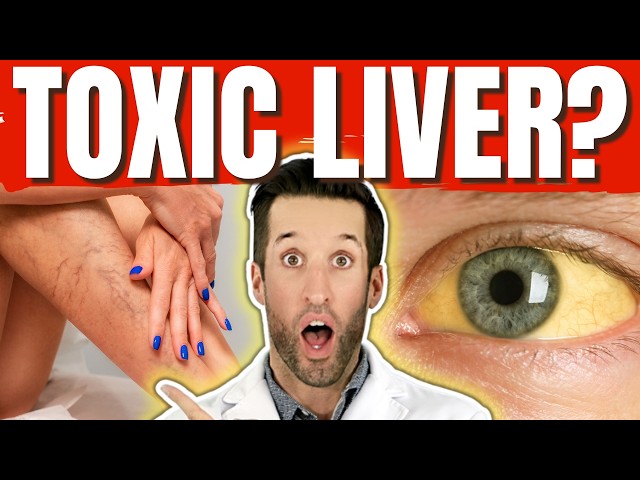 Liver Toxic? 8 Warning Signs You Shouldn’t Ignore!