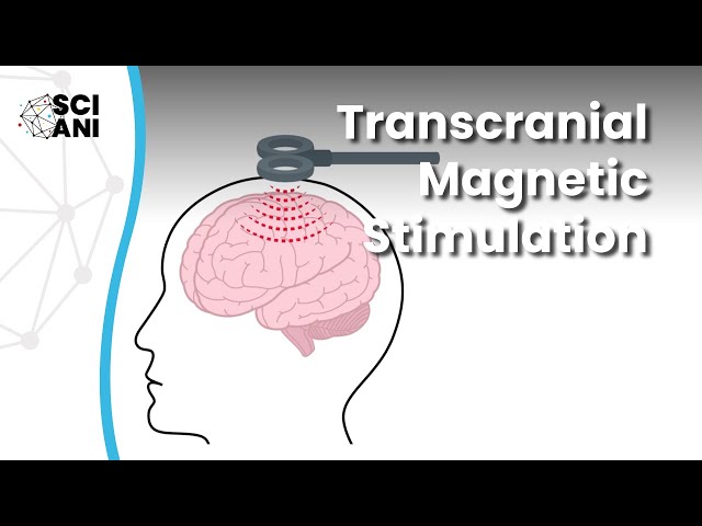 What is Transcranial Magnetic Stimulation and how can it help me?