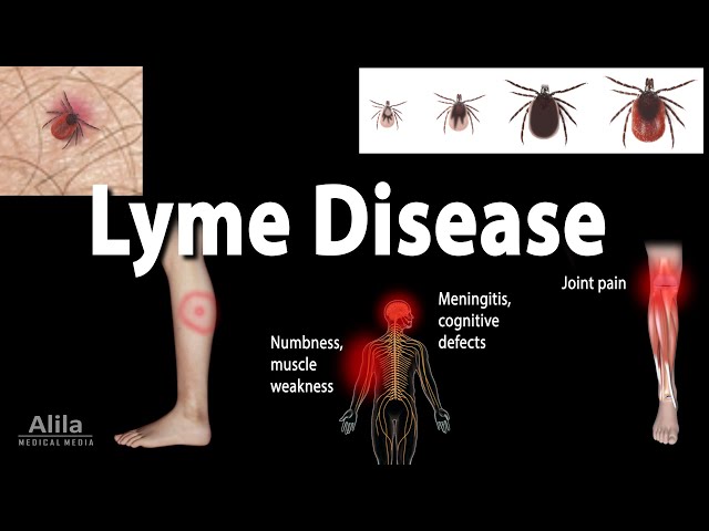 Lyme Disease, Animation