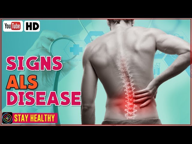 ALS Disease - Amyotrophic Lateral Sclerosis  Signs and Symptoms You Should Know