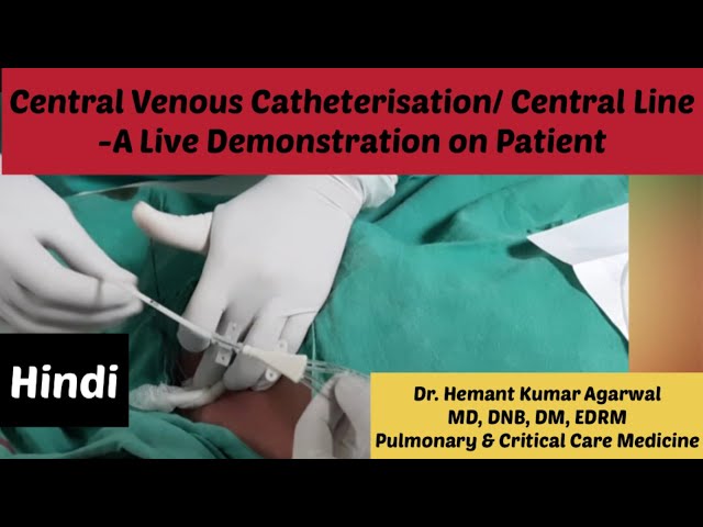 Central Venous Catheterisation (HINDI)/ Central Line/ Sub clavian Vein Catheterisation/ CVP