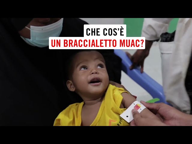 Che cos'è un braccialetto MUAC?