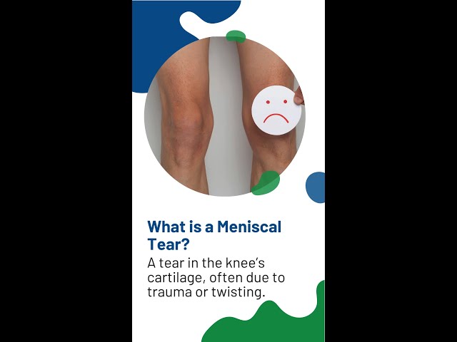 Meniscal Tears A Risk Factor for Knee Arthritis? #shorts