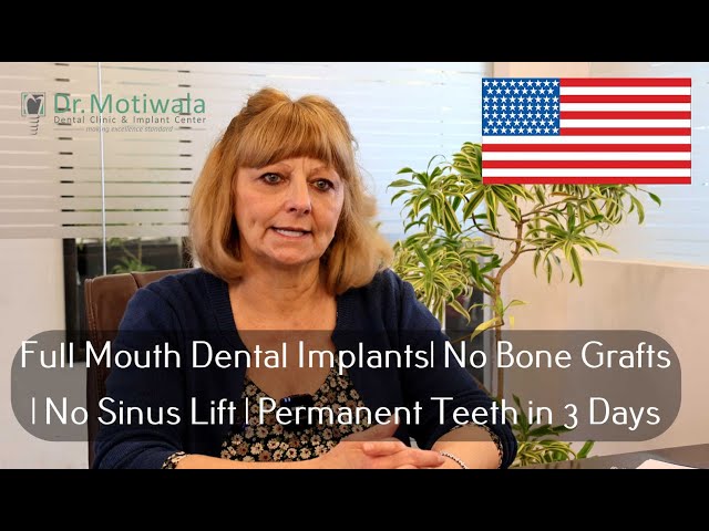 Full Mouth Dental Implants with 14 teeth per arch | Single Piece Implants -By Dr. Irfan Ali Motiwala