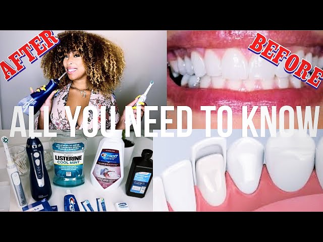 Are My Teeth Fake? | Secret to White Teeth