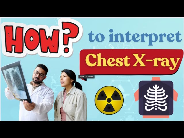 How to interpret Chest x-ray : simple ways to interpret # #nursing #xray