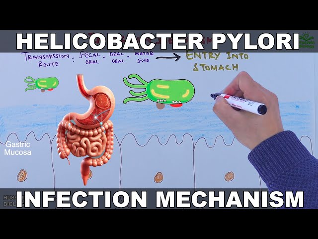 Helicobacter Pylori Infection Mechanism | Gastric Ulcer