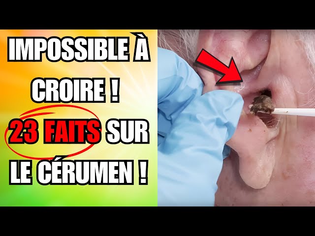 23 Faits INCROYABLES sur le Cérumen que 95 % des Gens IGNORENT ! 🔍😲 #BienÊtre #Découverte