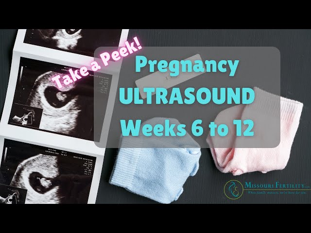 Take a Peek: Weeks 6 to 12 in Pregnancy Scans | Ultrasounds!