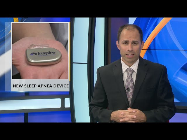 New Sleep Apnea Device: Inspire