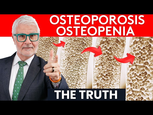 Dr. Gundry Reveals The Truth About Osteoporosis / Osteopenia Symptoms