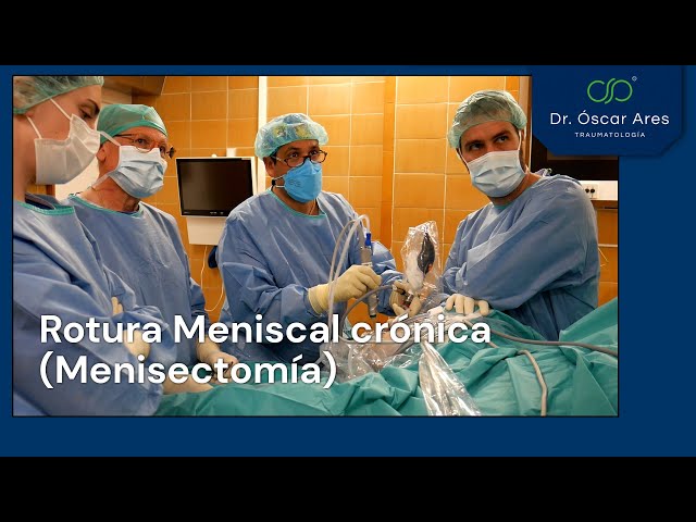 Rotura Meniscal crónica - Menisectomia parcial - Dr. Oscar Ares