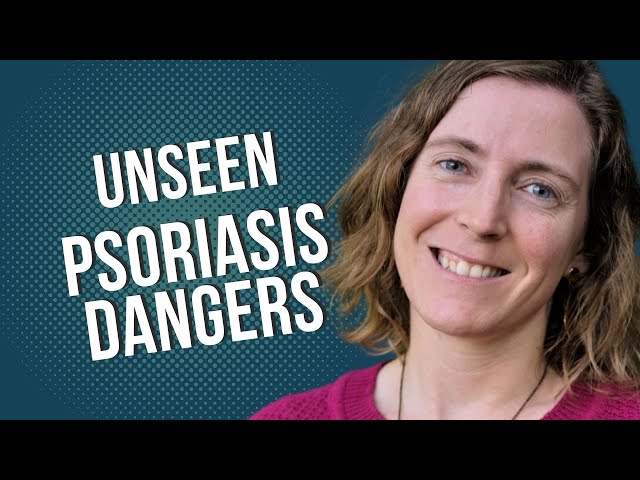 Unseen Psoriasis Dangers: Home Toxins Exposed