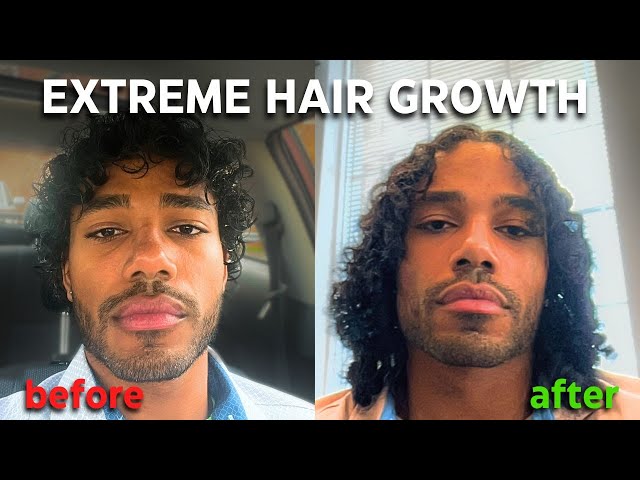 6 Tips To Grow Your Hair Super FAST (Extreme Growth Guaranteed)