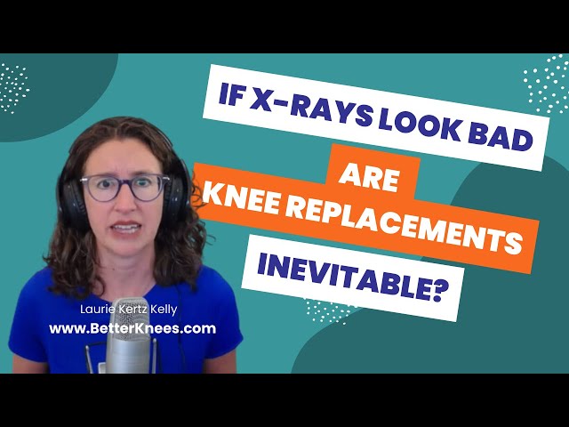 If your X-rays look bad, are knee replacements inevitable?