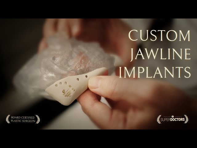 Custom Jawline Implants in 2025: Perfecting Facial Bone Structure in Plastic Surgery