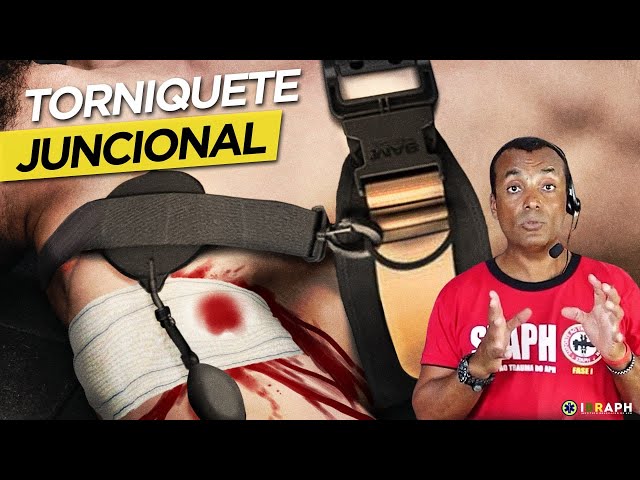 Torniquetes Juncionais: Aplicáveis Onde Torniquetes NÃO Funcionam?