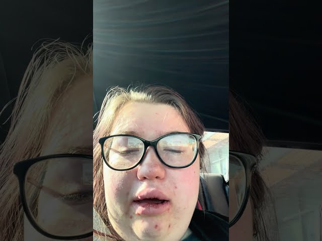 wisdom teeth removal