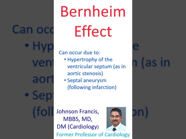 Bernheim Effect