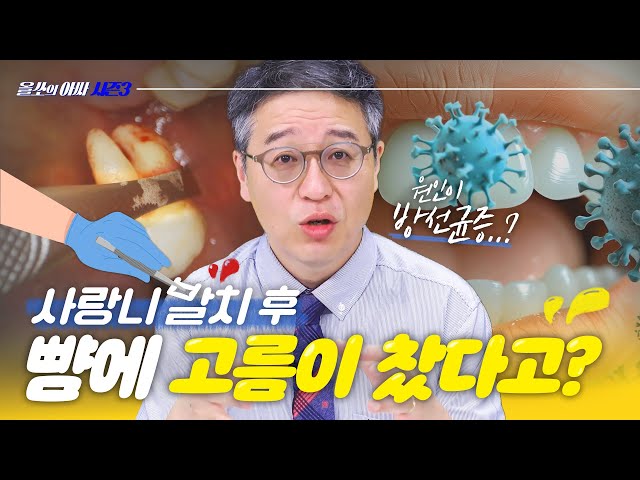 사랑니 뽑았다가 뺨에 고름?! 방선균증이 뭐길래..?😥- [올쏘의 아싸 시즌3 뉴.진.스] EP34