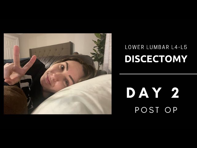 Lower Lumbar Discectomy L4-L5 | Day 2 Post Op