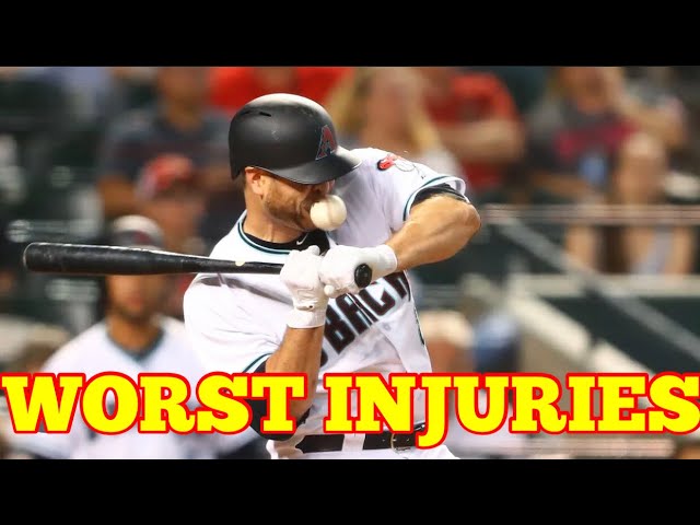 MLB | Worst Injuries Compilation in the MLB