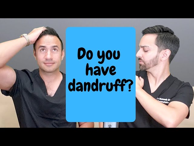 How To Treat Dandruff - Dermatology Hacks