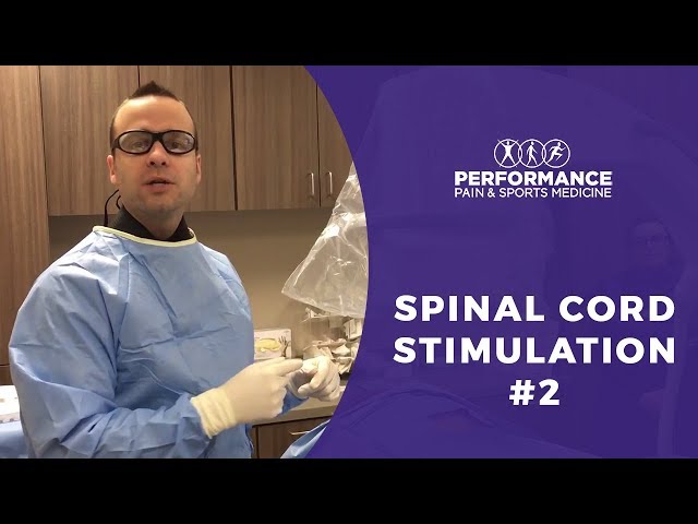 Spinal cord stimulation #2