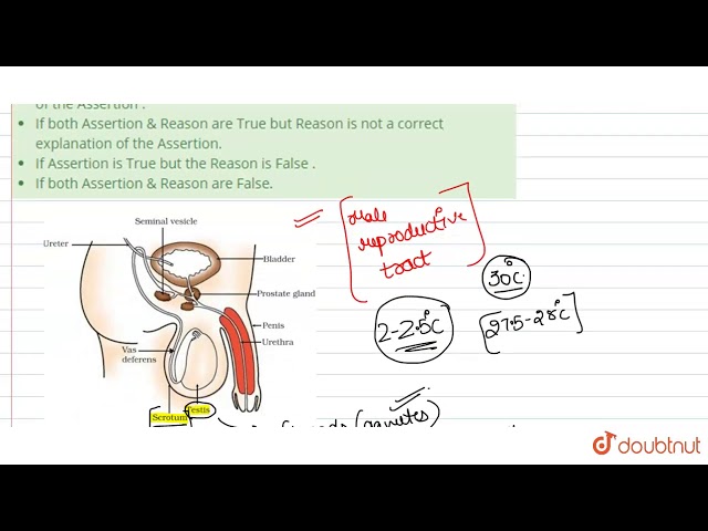 A : The scrotum acts as temperature regulator for the testes R : Wall of scrotum is