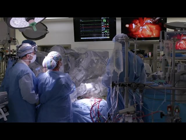 Robotically Assisted Heart Surgery | What to Expect