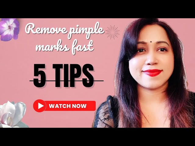 SAY GOODBYE TO PIMPLE MARKS :FAST REMEDIES THAT WORK WONDERS