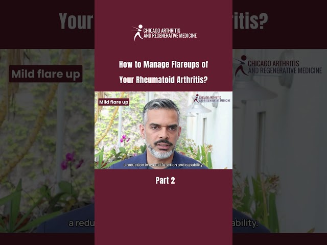 How to manage flare-ups of your RA? | PART 2 #ChicagoArthritis #RheumatoidArthritis #RA