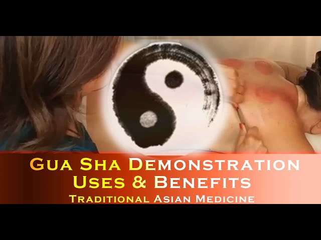 Gua Sha Demonstration