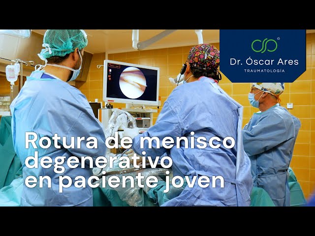 Rotura de menisco degenerativo en paciente joven - Dr. Oscar Ares