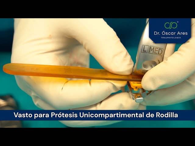 Vasto para prótesis unicompartimental de rodilla