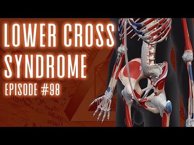 EPISODE 98 - LOWER CROSS SYNDROME