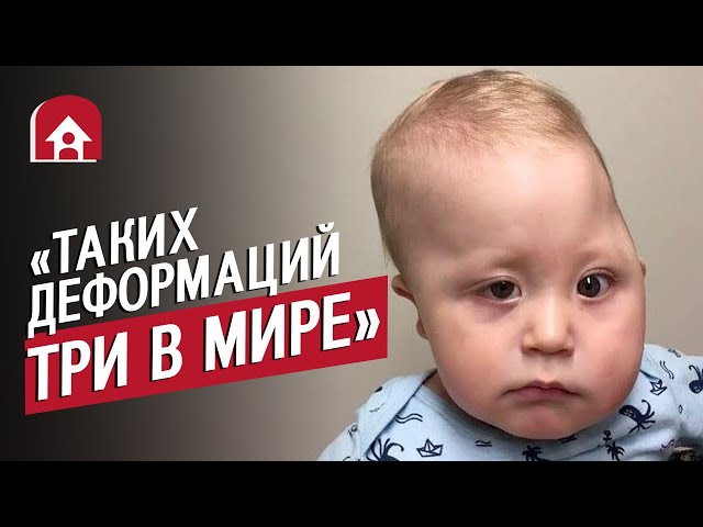 У моего сына деформация черепа: Таня | Быть мамой