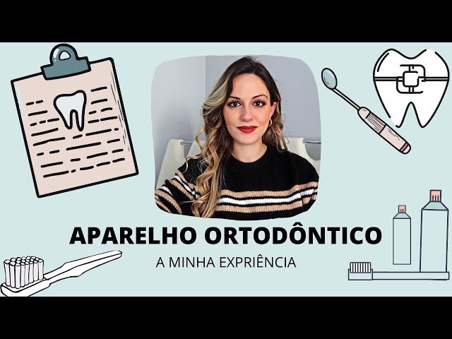 A MINHA EXPERIÊNCIA COM O APARELHO ORTODÔNTICO CONVENCIONAL CLÁSSICO FIXO